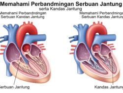 Memahami Perbandingan Serbuan Jantung serta Kandas Jantung